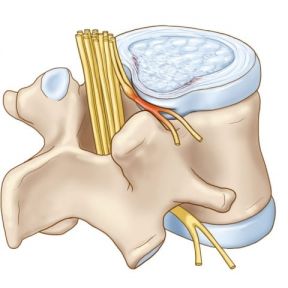 Chèn ép dây thần kinh - triệu chứng và phương pháp điều trị