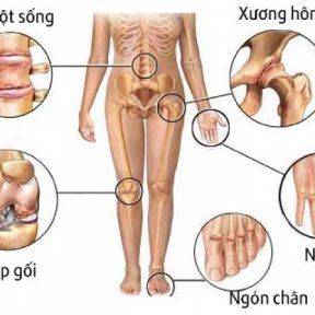 Tìm hiểu triệu chứng thực thể bệnh cơ xương khớp