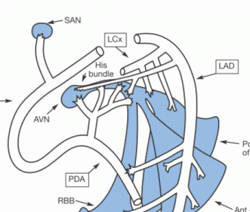 Bệnh xơ vữa động mạch