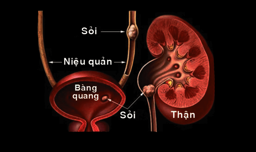 Cách chữa sùi mào gà triệt để ở nam giới và nữ giới